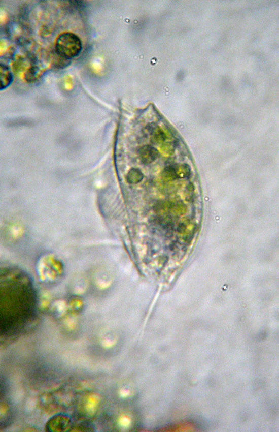 Tre Protozoi da identificare (se possibile)